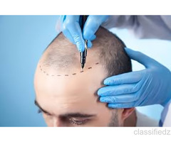 Dr. Haror’s Wellness — A Place Where Hair and Confidence Are Restored