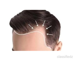 Dr. Haror’s Wellness — A Place Where Hair and Confidence Are Restored