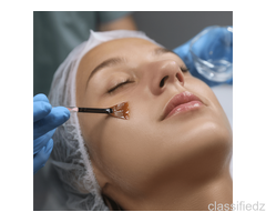 Best Chemical Peel Treatment in Noida