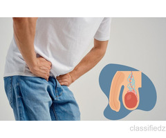 Varicocele Radiology: Advanced Diagnosis and Minimally Invasive Treatment