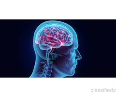 Brain Hemorrhage Treatment | Advanced Neurovascular Care by Experts
