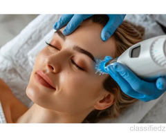 HIFU Treatment in Delhi – Non-Surgical Skin Tightening