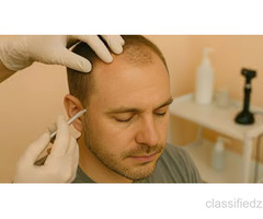 Restore More Than Just Hair — Restore Your Confidence!