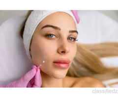 Thread Lift Treatment in Delhi – Non-Surgical Face Lift 