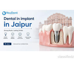 Dental Implants in Jaipur – Get Your Perfect Smile Back Today!