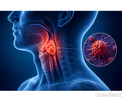 Head & Neck Cancer Surgery in Delhi NCR – Expert Treatment & Care