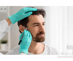 No Shave, No Stress — Unshaven Hair Transplant in Delhi is Here!