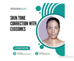 Skin Tone Correction with Exosomes
