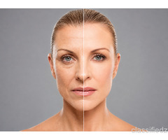 Best Face Rejuvenation Surgery in Mumbai by Expert Plastic Surgeons