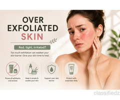 Over Exfoliated Skin