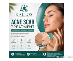Acne Scar Treatment in Hyderabad – Clearer, Smoother-Looking Skin