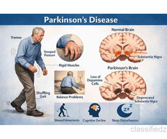 Comprehensive Parkinson's Care in Vasai | Sunshine Wellness Centre