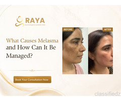 Chemical Peel in Raj Nagar | Skin Renewal Treatment